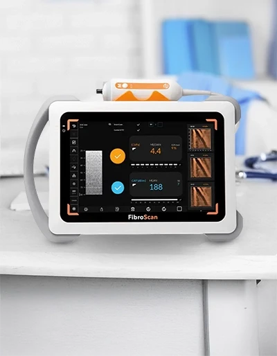 Aparelho de FibroScan para exame hepático